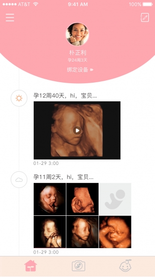 胎儿相机iphone版 V4.6.9