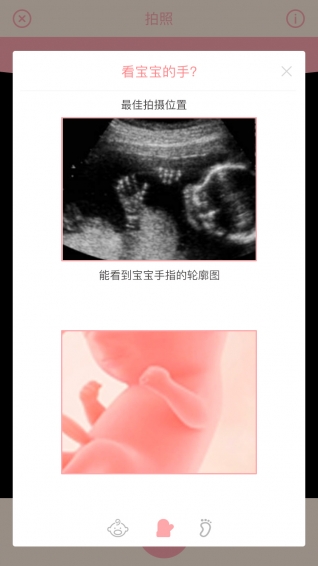 胎儿相机iphone版 V4.6.9